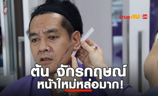 หน้าใหม่หล่อมาก! ต้น จักรกฤษณ์ ศัลย์ฯกระชากวัย