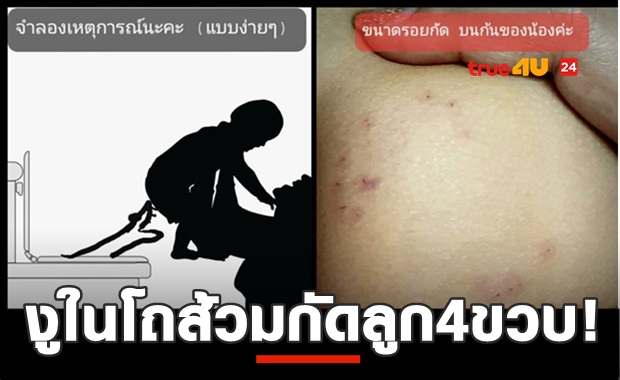 แม่โพสต์อุทาหรณ์ งูในโถส้วมกัดลูก4ขวบ!